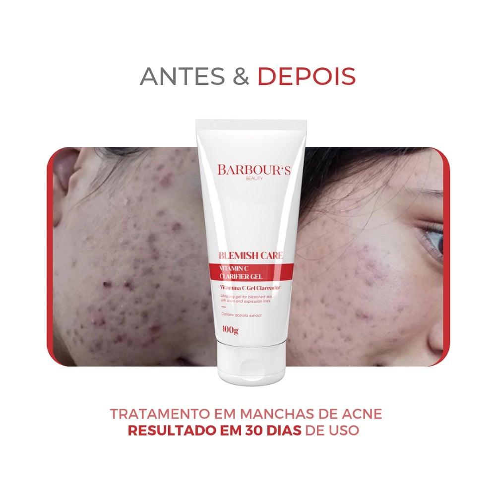 Kit Rotina Clareadora Intensiva (6 Produtos - Tratamento rende 3 meses)