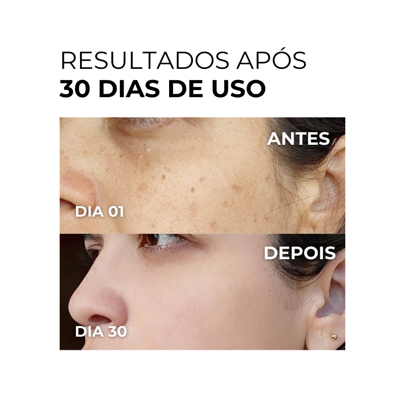 Vitamin C Clarifier Gel - Vitamina C Gel Clareador 100ml (Rende 3 meses de uso)