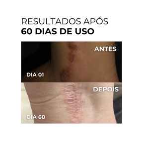 Vitamin C Clarifier Gel - Vitamina C Gel Clareador 100ml (Rende 3 meses de uso)