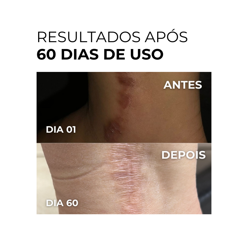 Vitamin C Clarifier Gel - Vitamina C Gel Clareador 100ml (Rende 3 meses de uso)