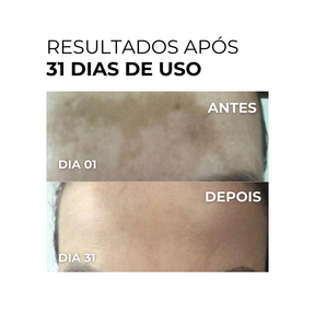Vitamin C Clarifier Gel - Vitamina C Gel Clareador 100ml (Rende 3 meses de uso)