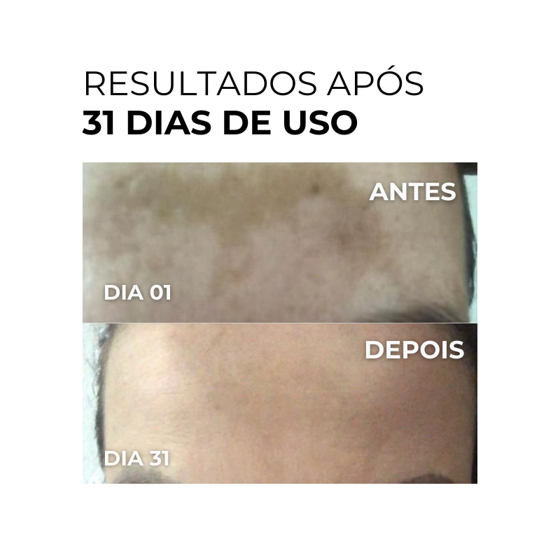 Vitamin C Clarifier Gel - Vitamina C Gel Clareador 100ml (Rende 3 meses de uso)